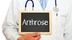 Arthrose