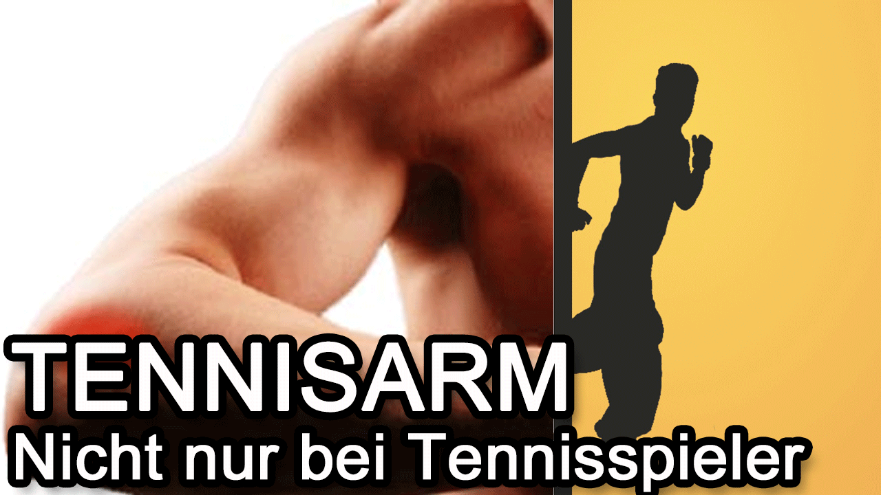 Tennisarm