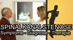 Spinalkanalstenose