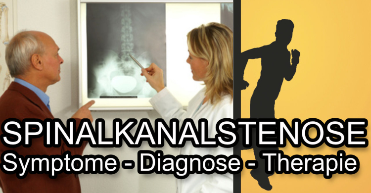 Spinalkanalstenose