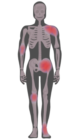 Schmerzbereiche behandeln